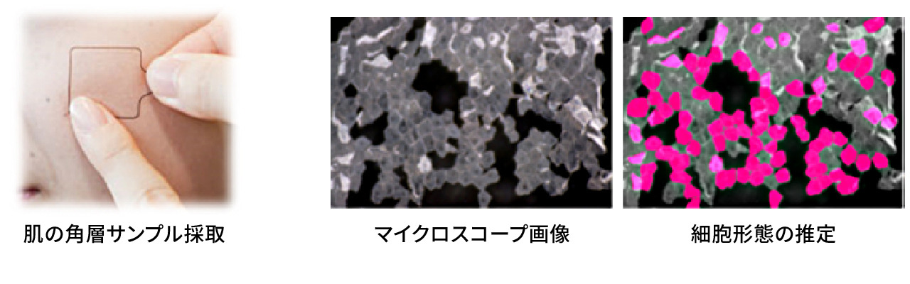 ディープラーニングによる角層バイオマーカー値と細胞形態の推定イメージ