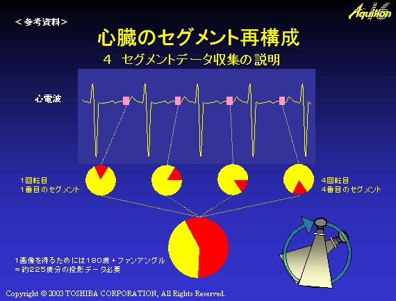 心臓のセグメント再構成