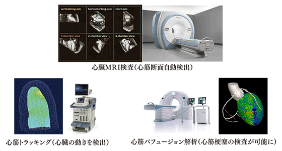 医用画像処理のフロー概略