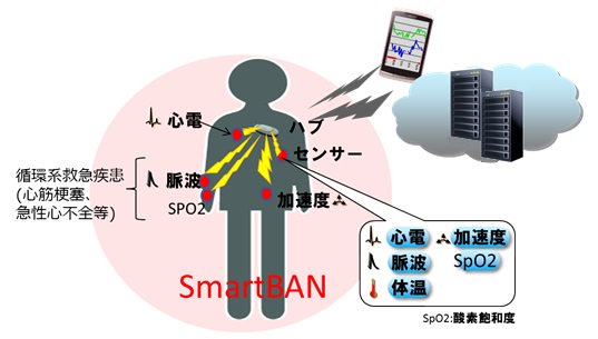 SmartBAN技術