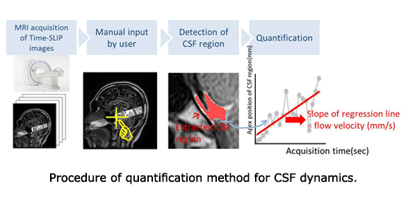 Procedure of quantification method for CSF dynamics.