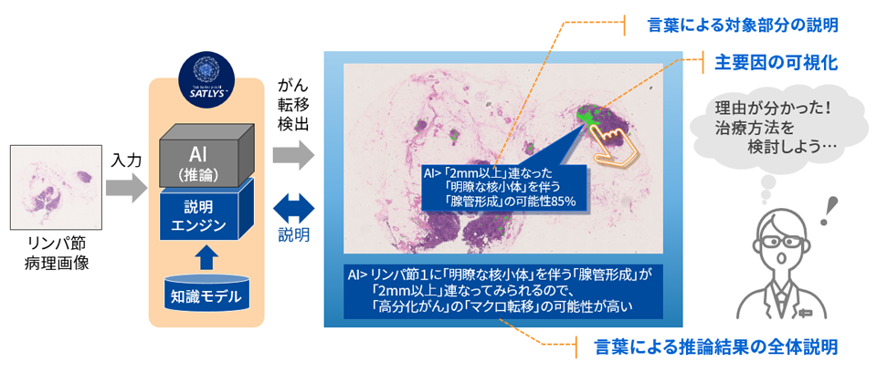 説明可能なAIの例のイメージ図