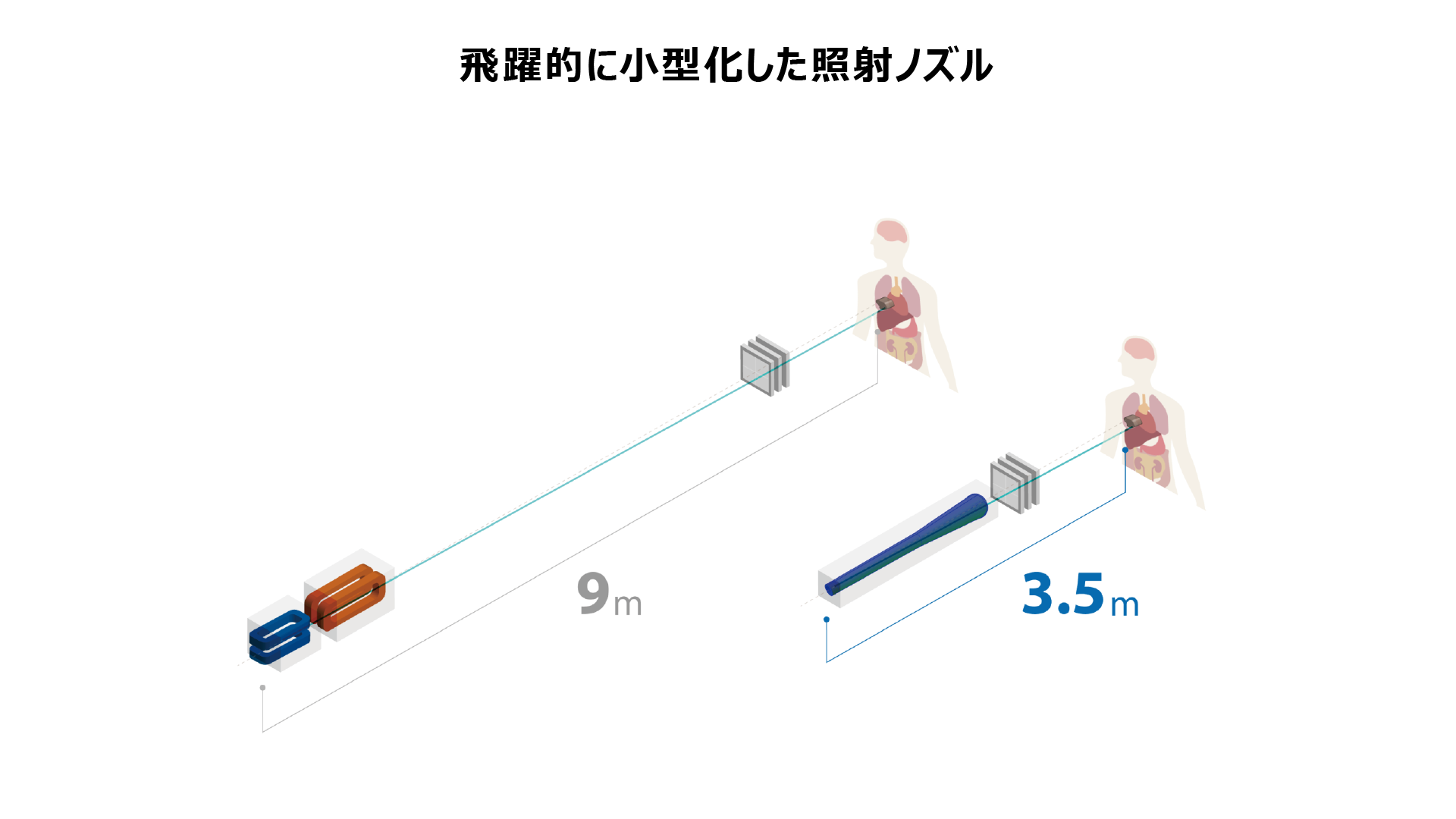 飛躍的に小型化した照射ノズル