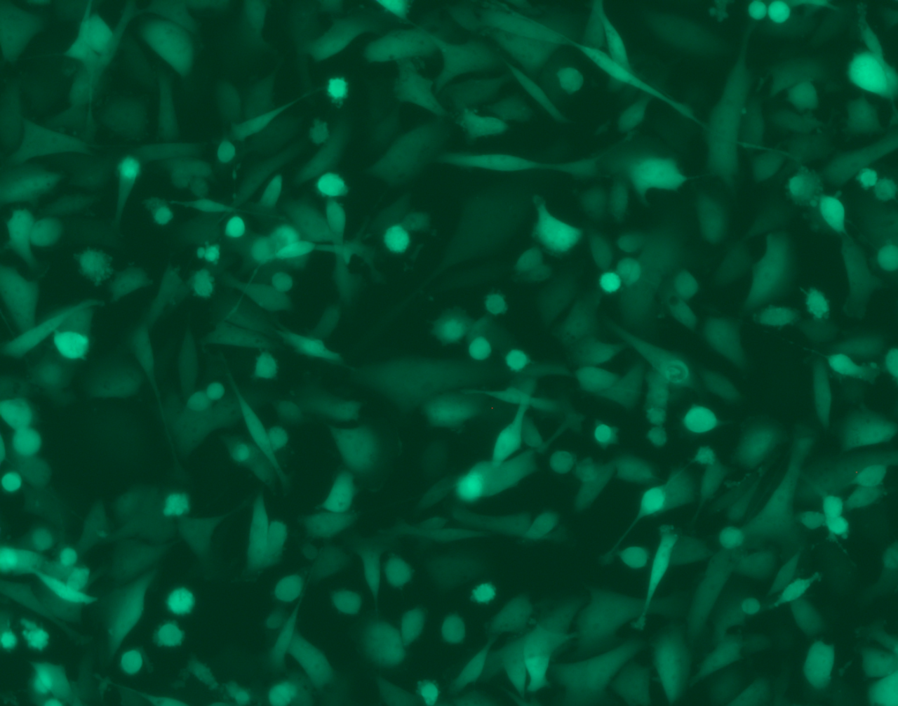 Breast cancer cells