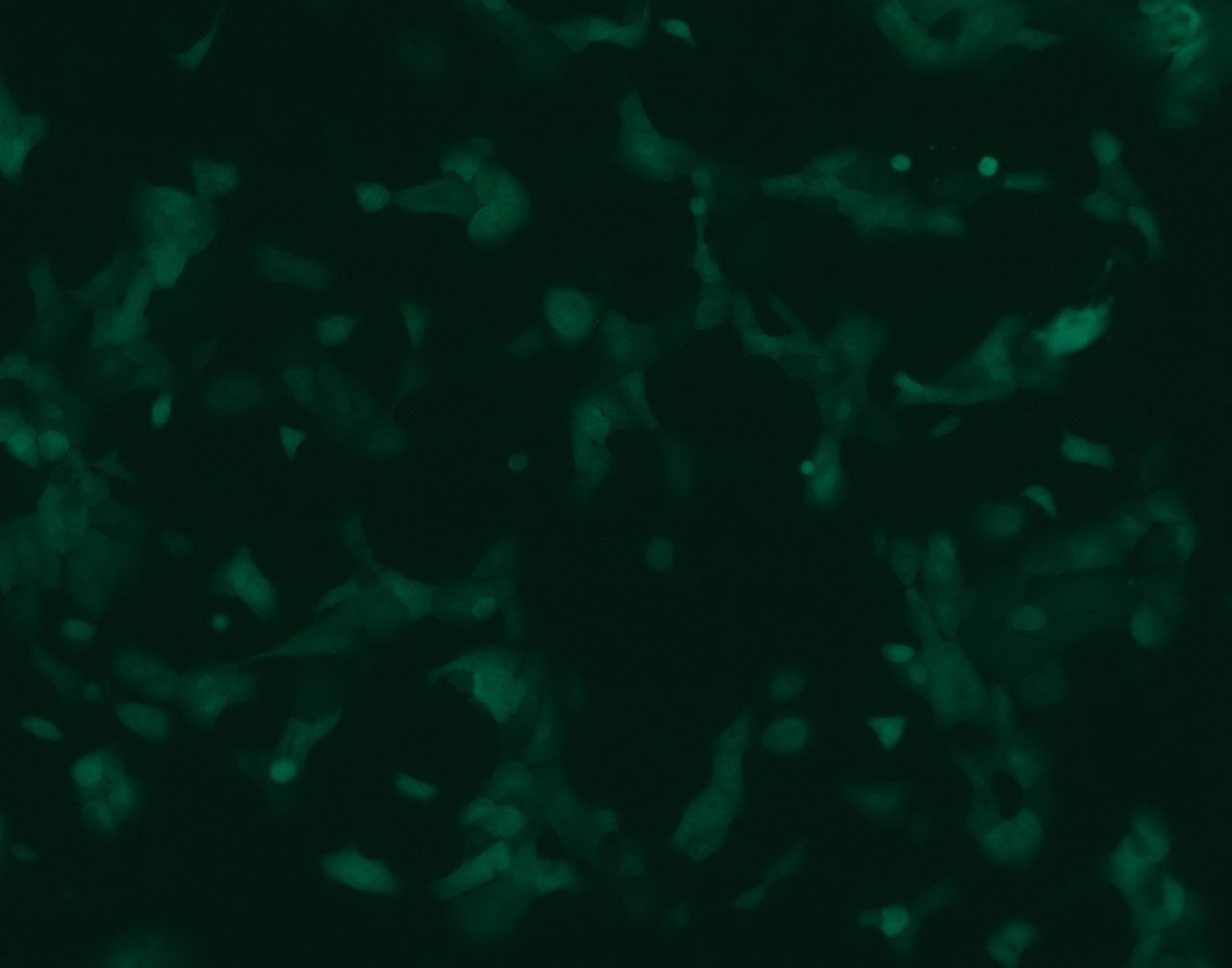 Normal mammary gland cells